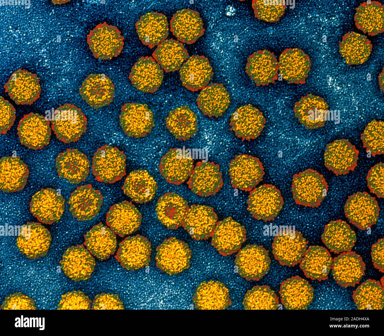 Parvoviruses. Coloured transmission electron micrograph (TEM) of