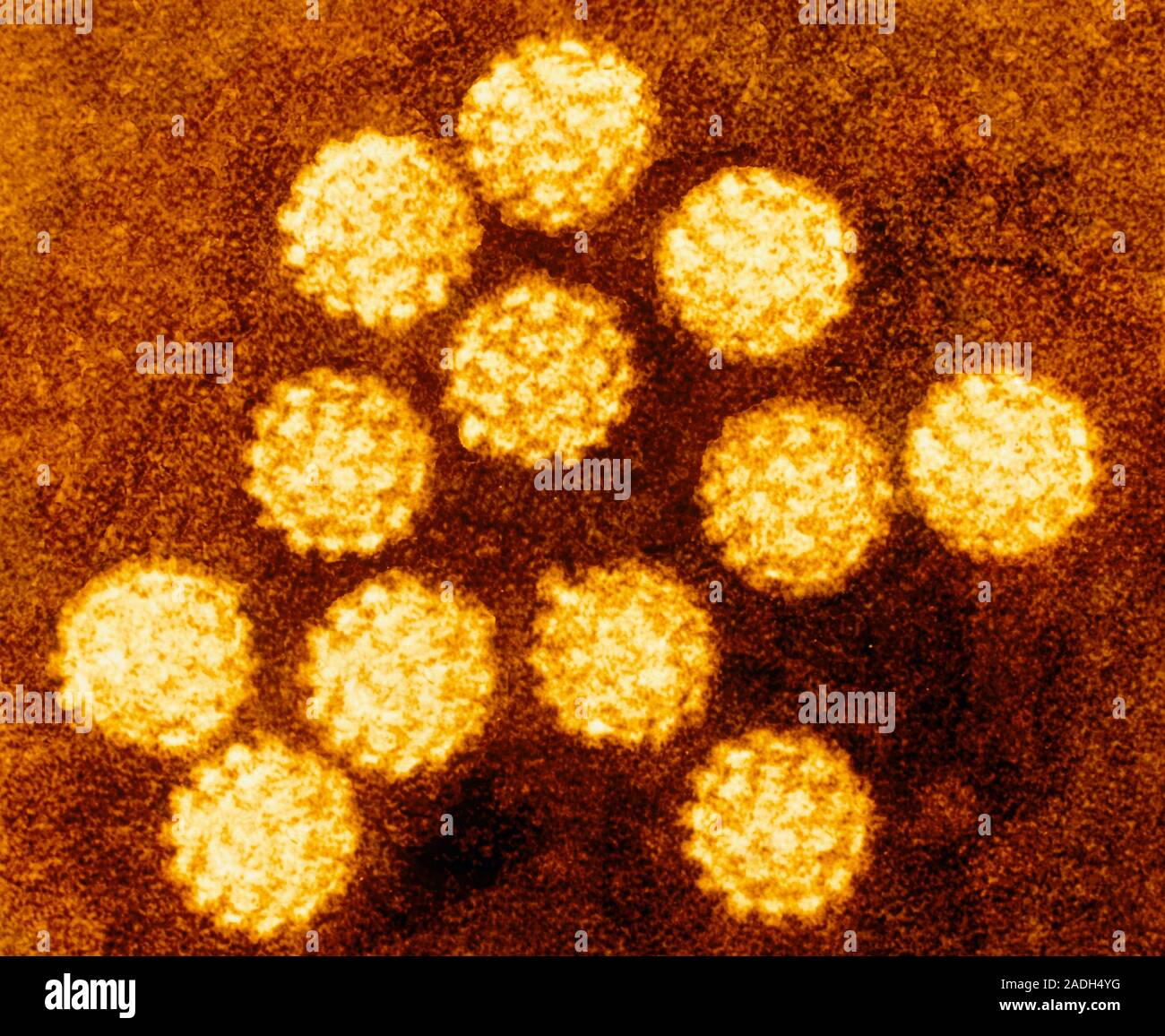 Wart viruses. Coloured transmission electron micrograph (TEM) of a group of papilloma viruses