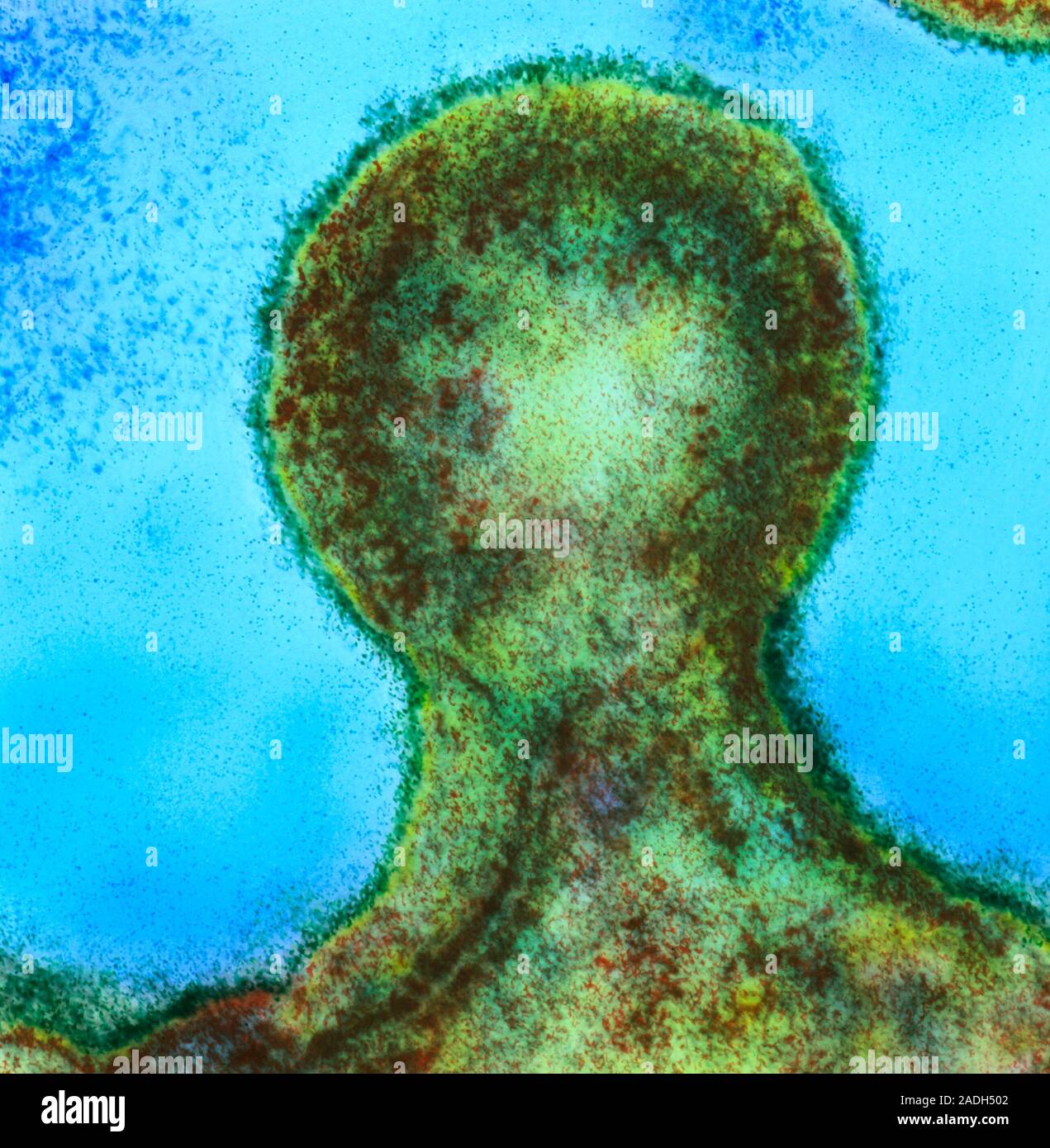 HIV virus. Coloured transmission electron micrograph (TEM) of a human