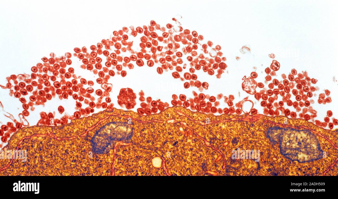 AIDS viruses. Coloured transmission electron micrograph (TEM) of rounded Human Immunodeficiency