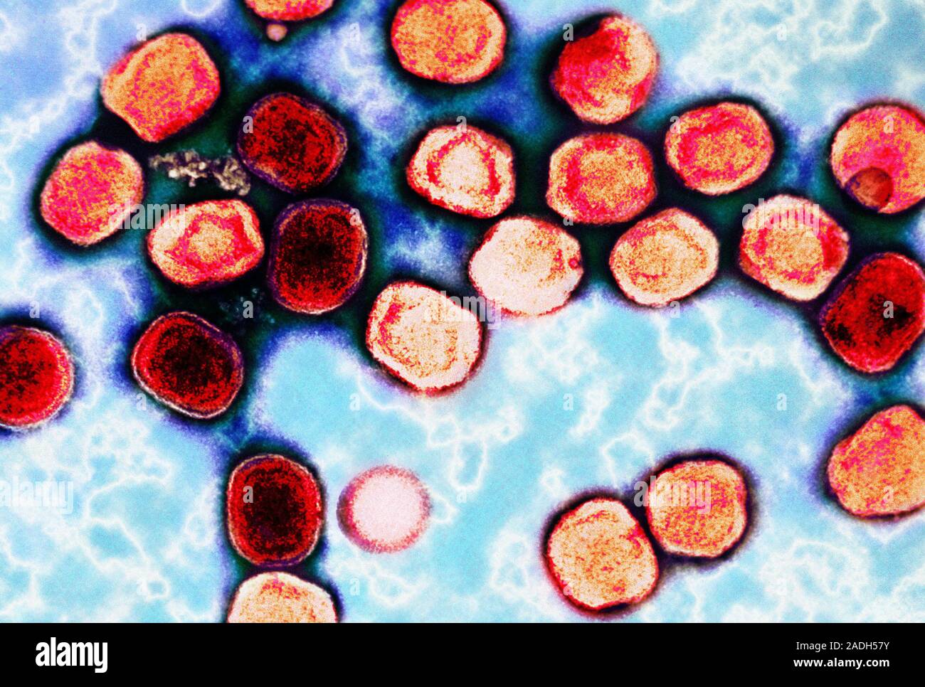 Vaccinia virus particles, coloured transmission electron micrograph (TEM). Vaccinia belongs to