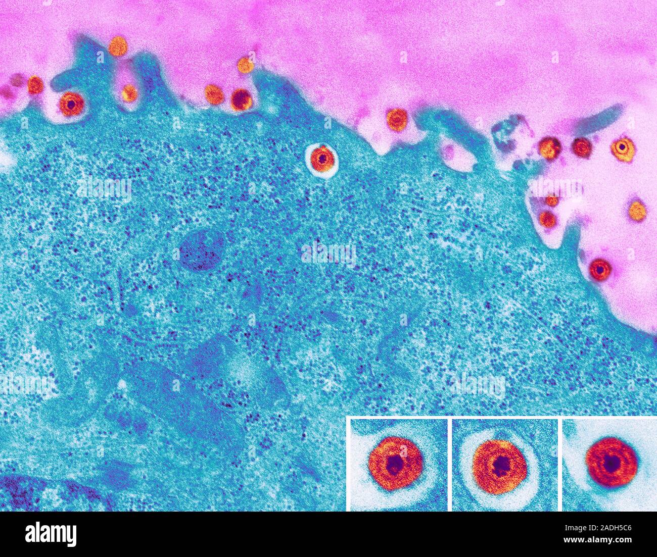 Herpes simplex viruses. Coloured transmission electron micrograph (TEM