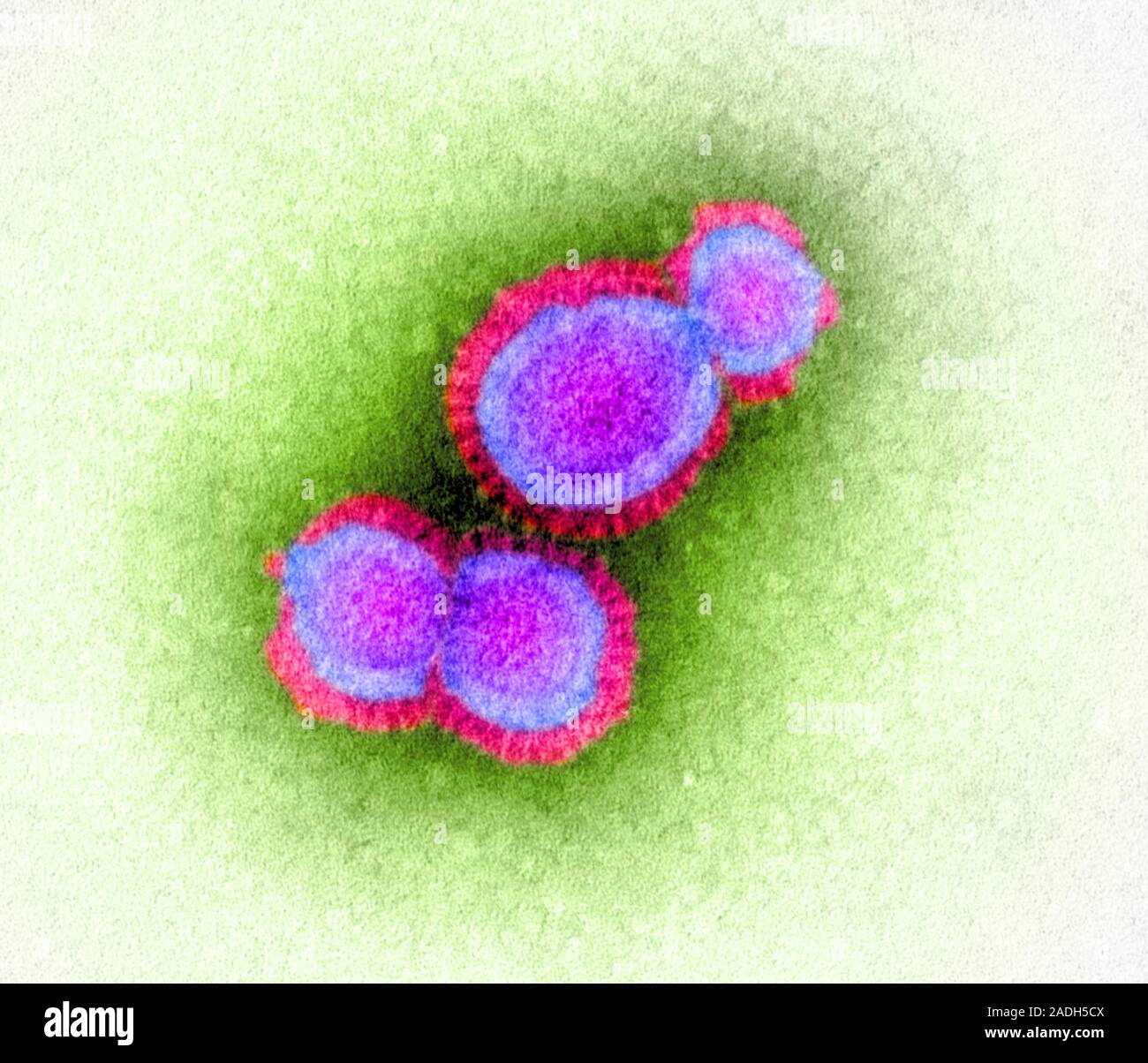 Грипп h5n1. Вирус гриппа под микроскопом. Вирус птичьего гриппа. Вирус h5n1. Вирус h5n1.