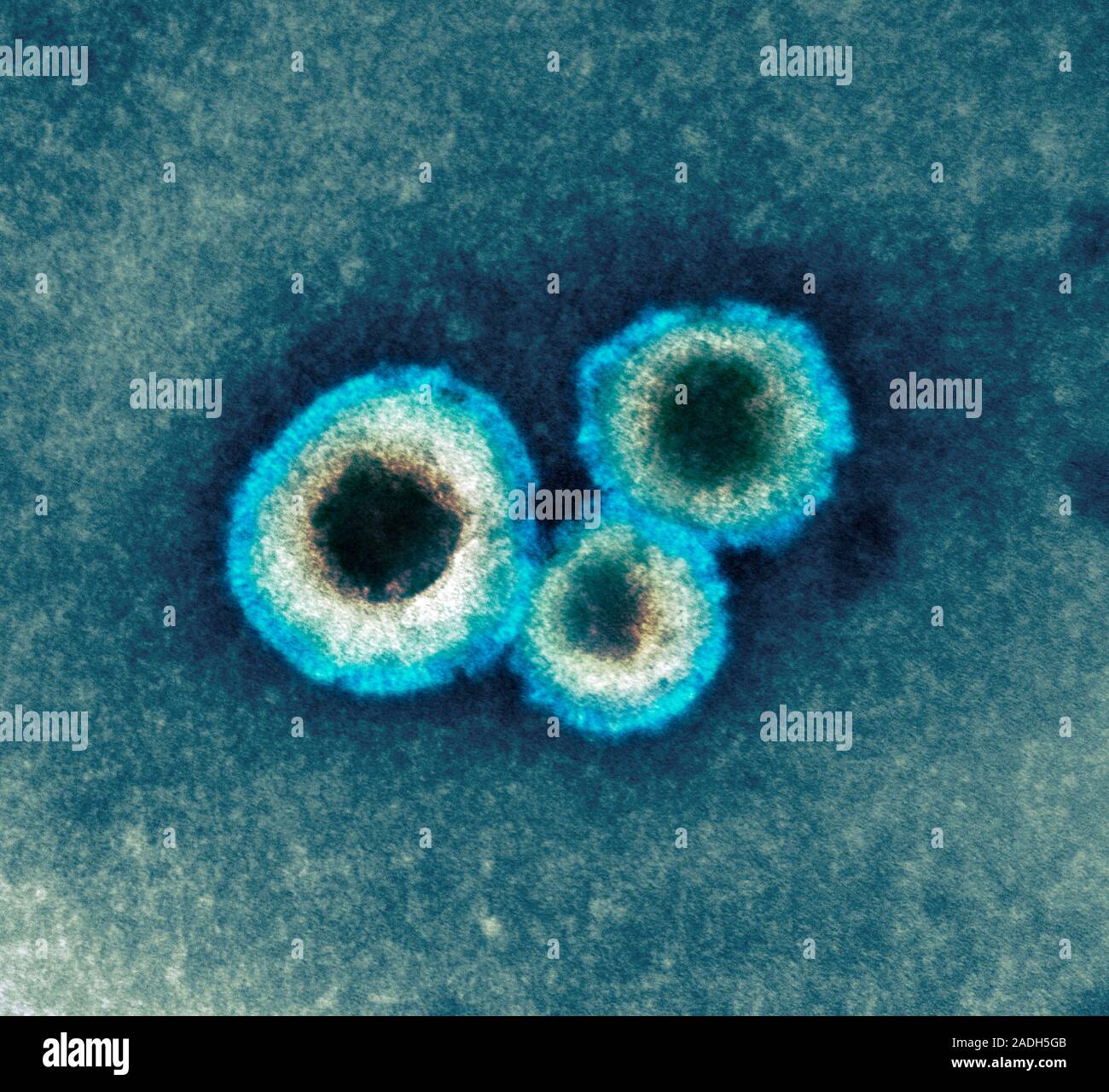 Human metapneumovirus particles. Coloured transmission electron 