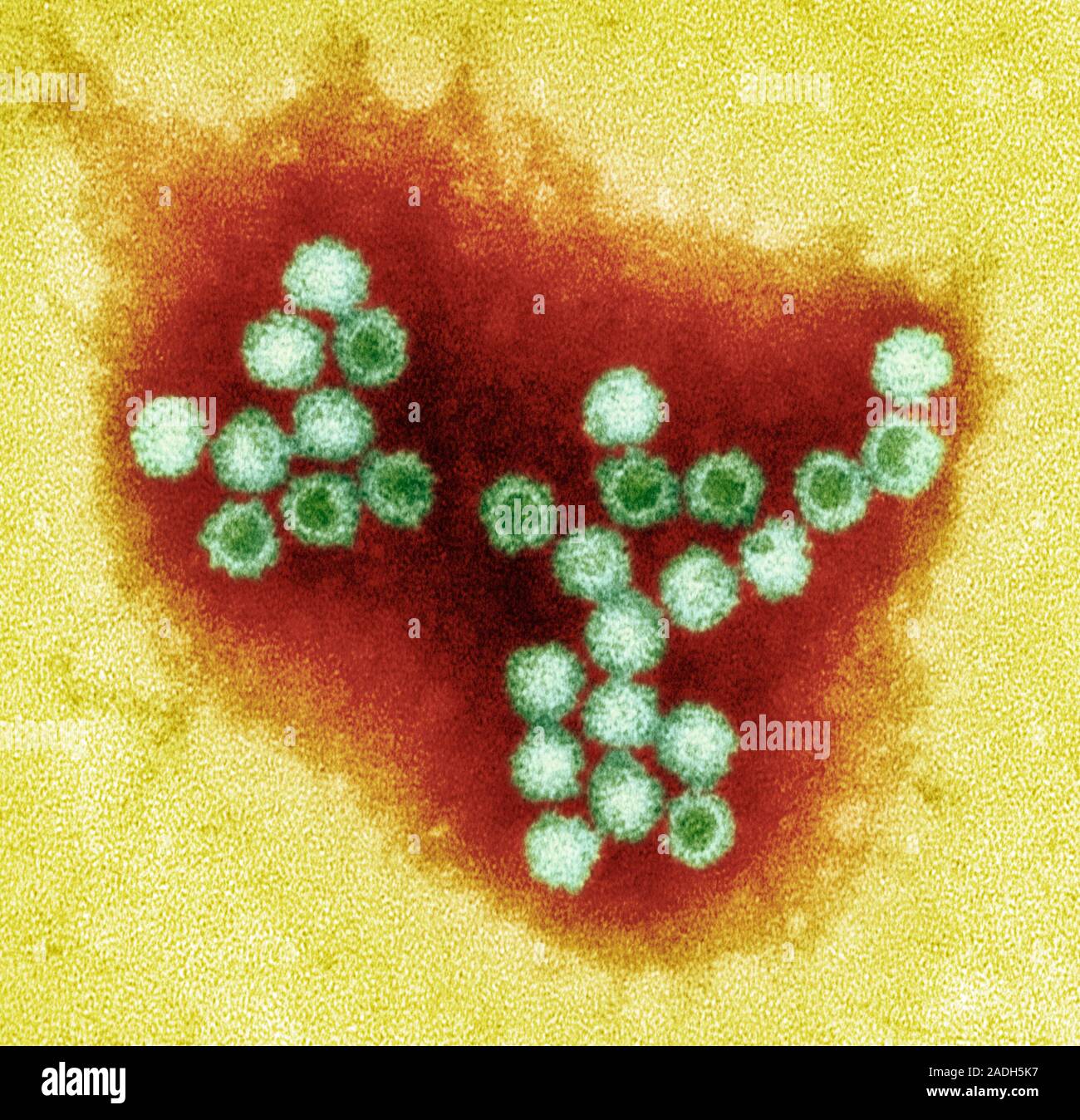 Norovirus particles. Coloured transmission electron micrograph (TEM) of