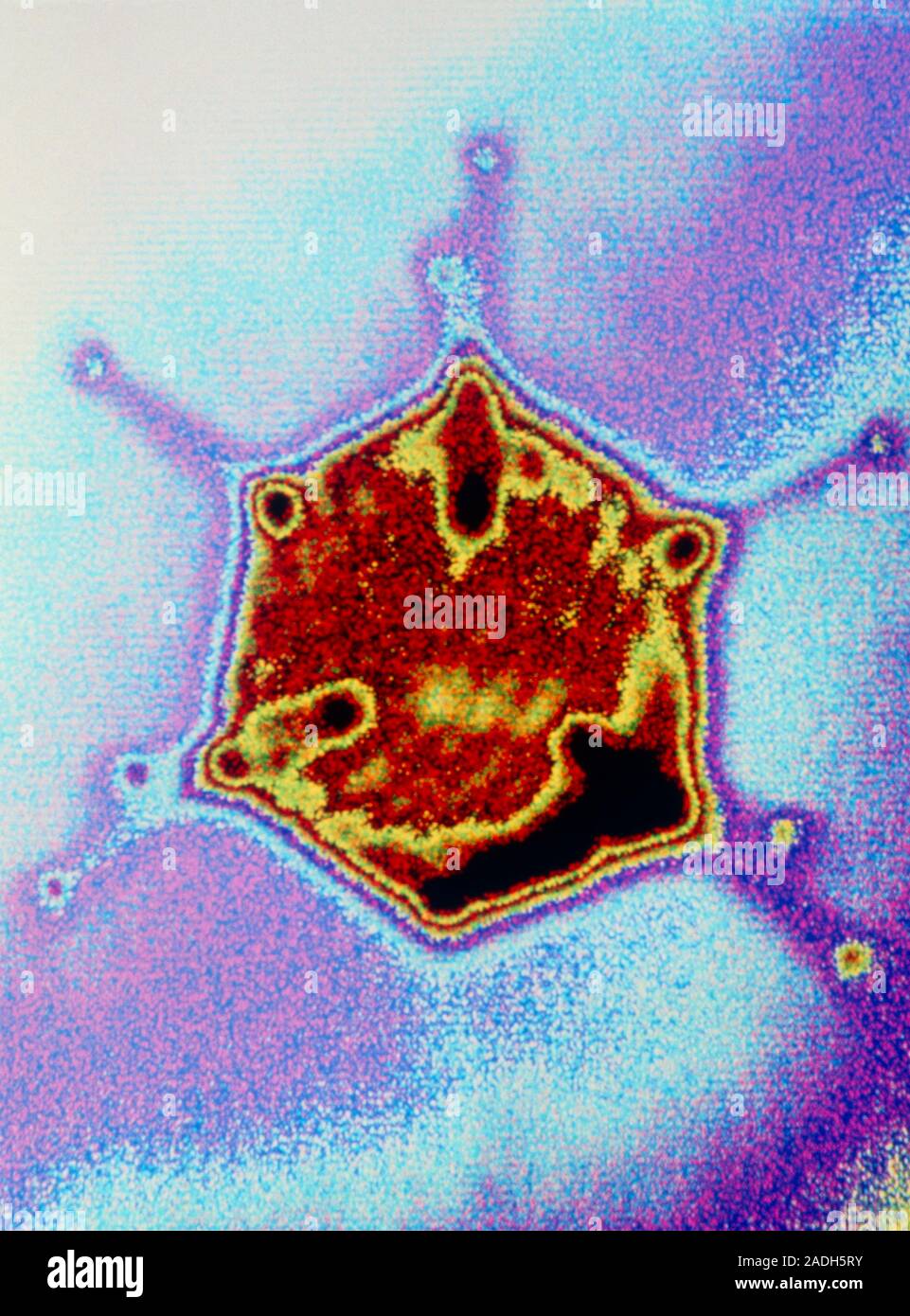 Adenovirus. Computer graphic image showing one adenovirus particle ...