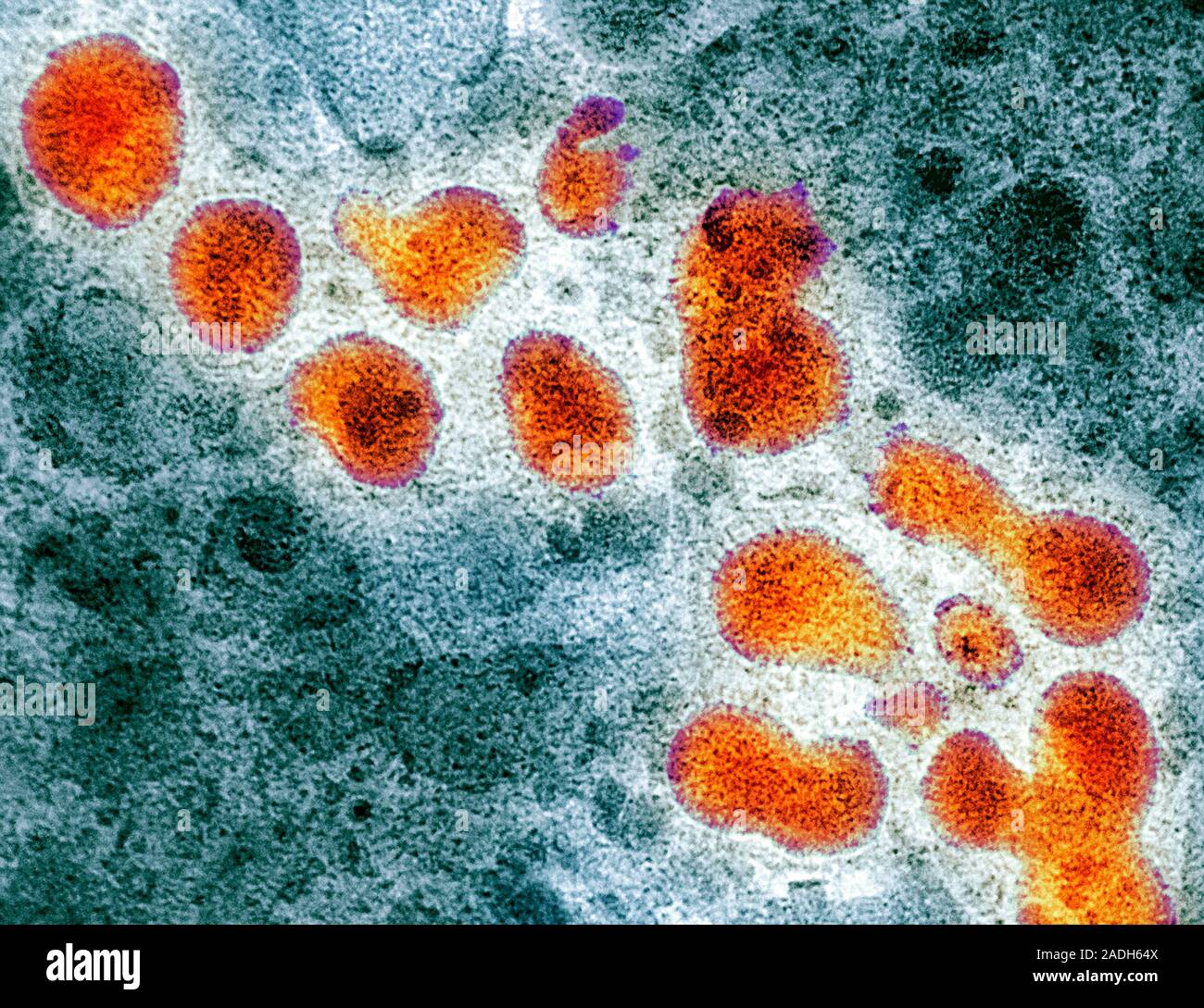 Грипп вызывают бактерии. Вирус h5n1. Птичий грипп под микроскопом. Вирус птичьего гриппа. Серотипа h1n1.