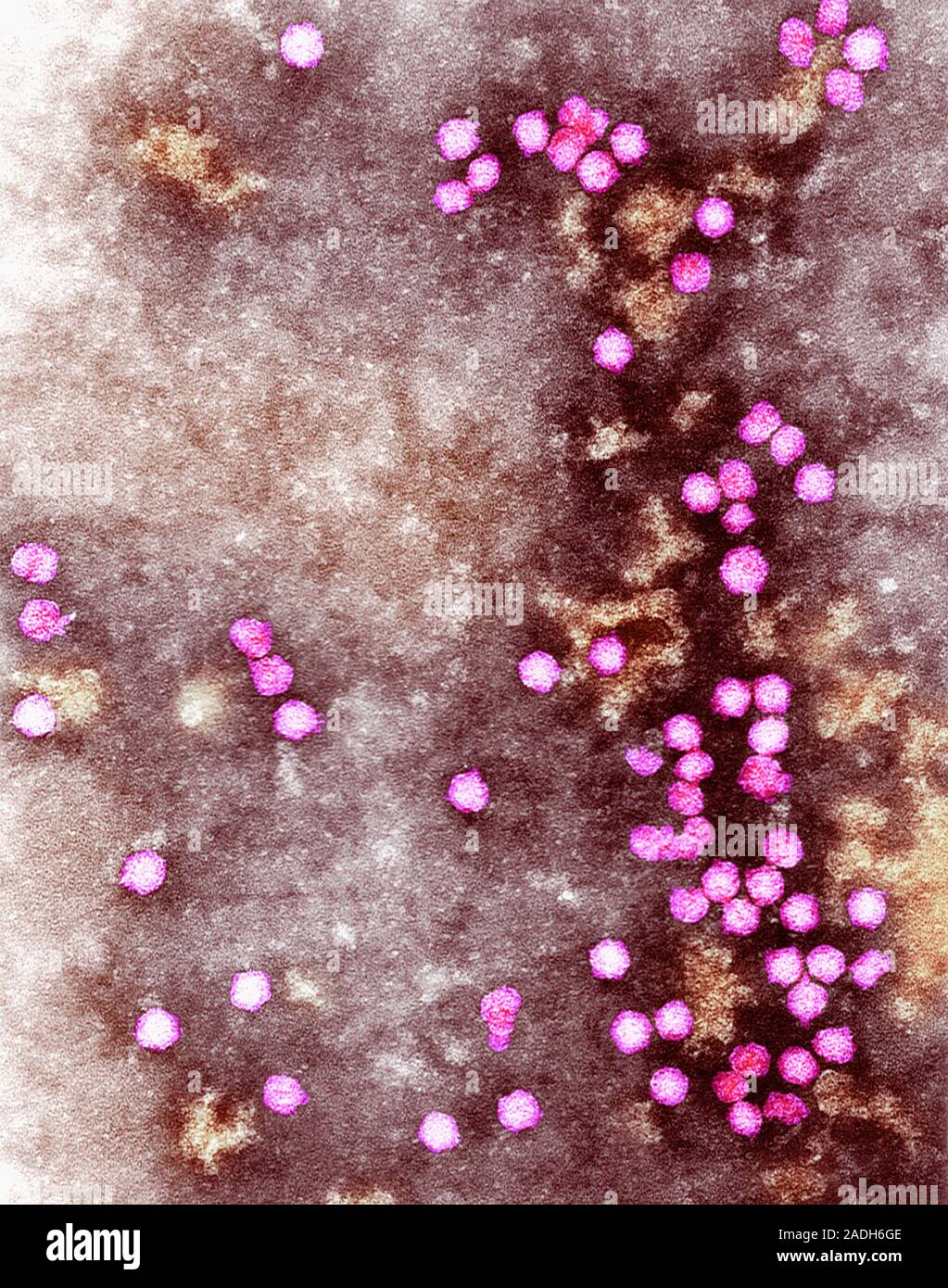 Pea enation mosaic virus. Coloured transmission electron micrograph