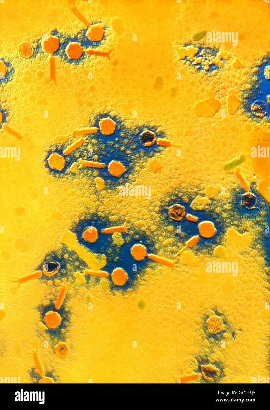 False-colour transmission electron micrograph (TEM) of a field of ...