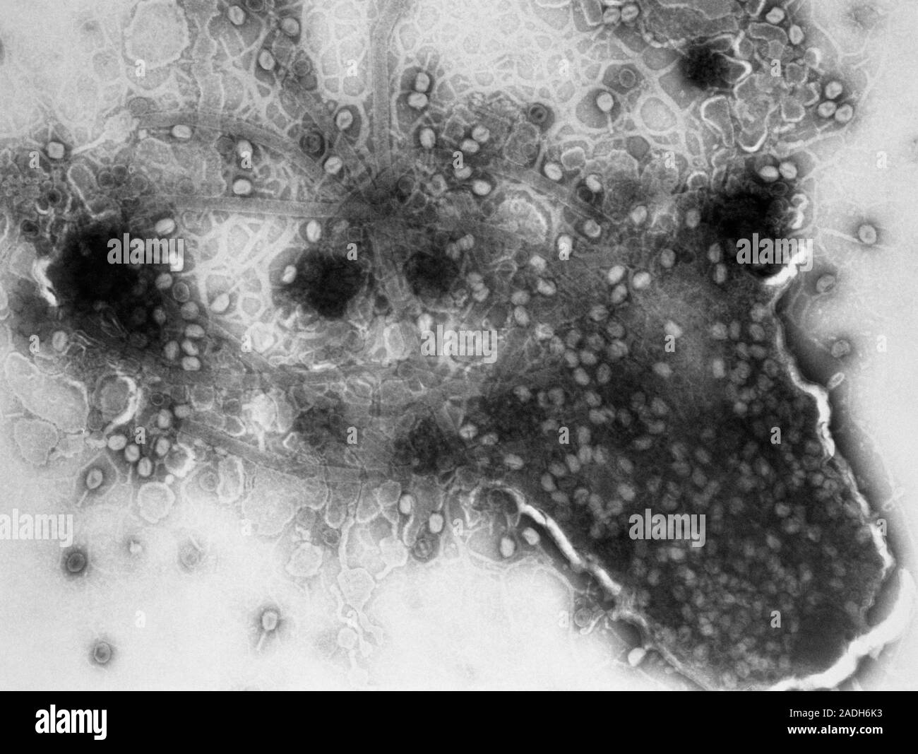 Transmission electron micrograph (TEM) showing lysis (destruction) of a ...