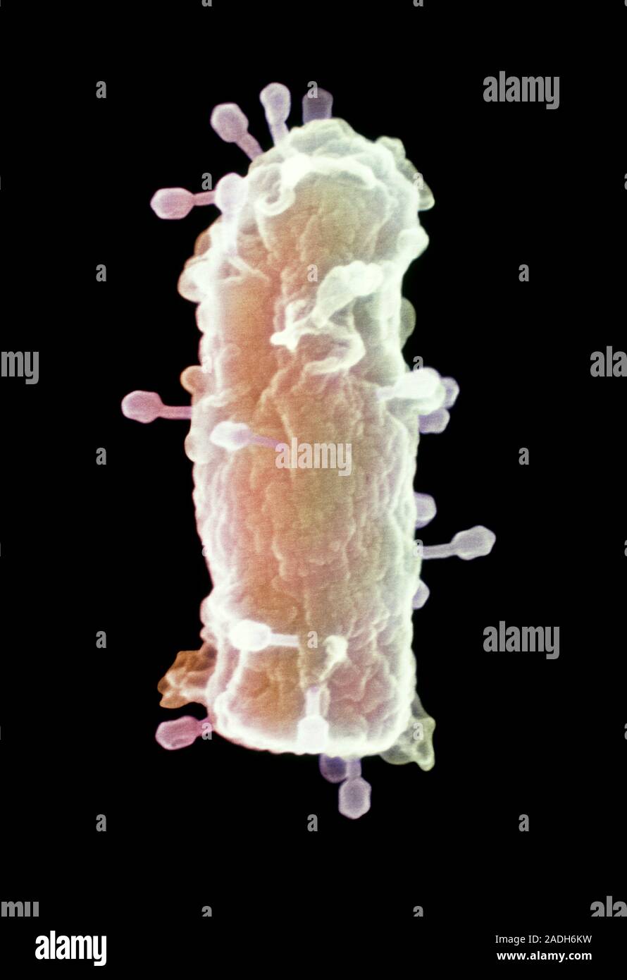 T4 bacteriophages on E.coli. Coloured scanning electron micrograph (SEM ...