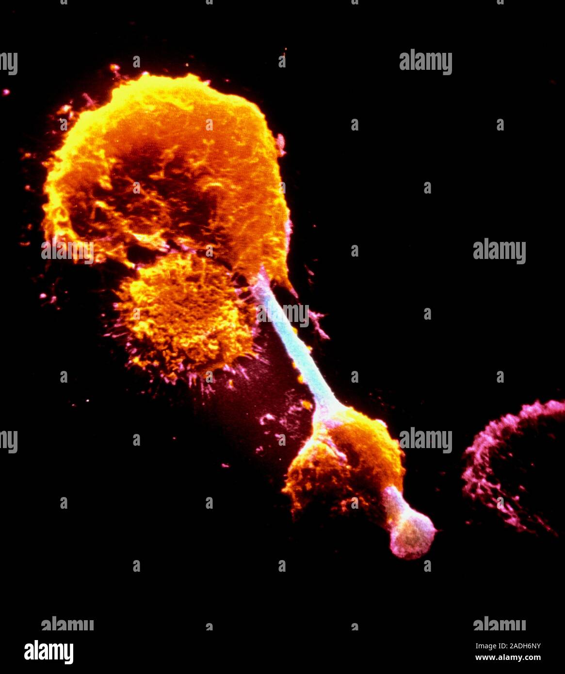 False-colour scanning electron micrograph of a macrophage impaled on an ...