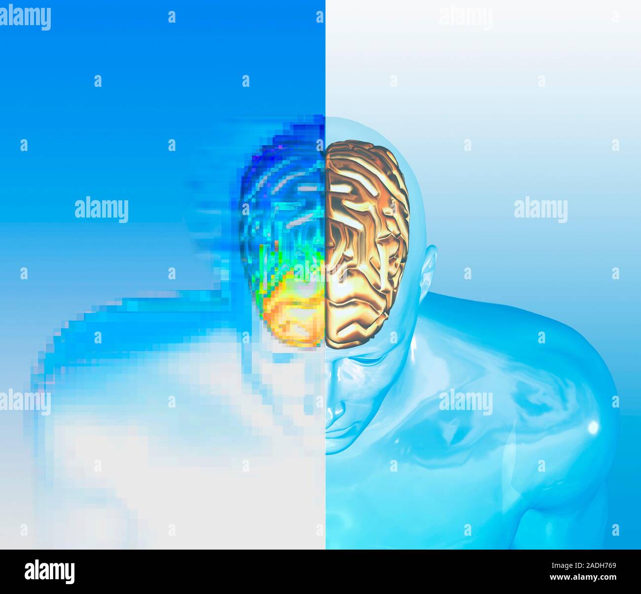 Alzheimer's disease. Conceptual computer artwork showing a glass figure with a golden brain. One side of the image is pixellated and the brain is colo Stock Photo