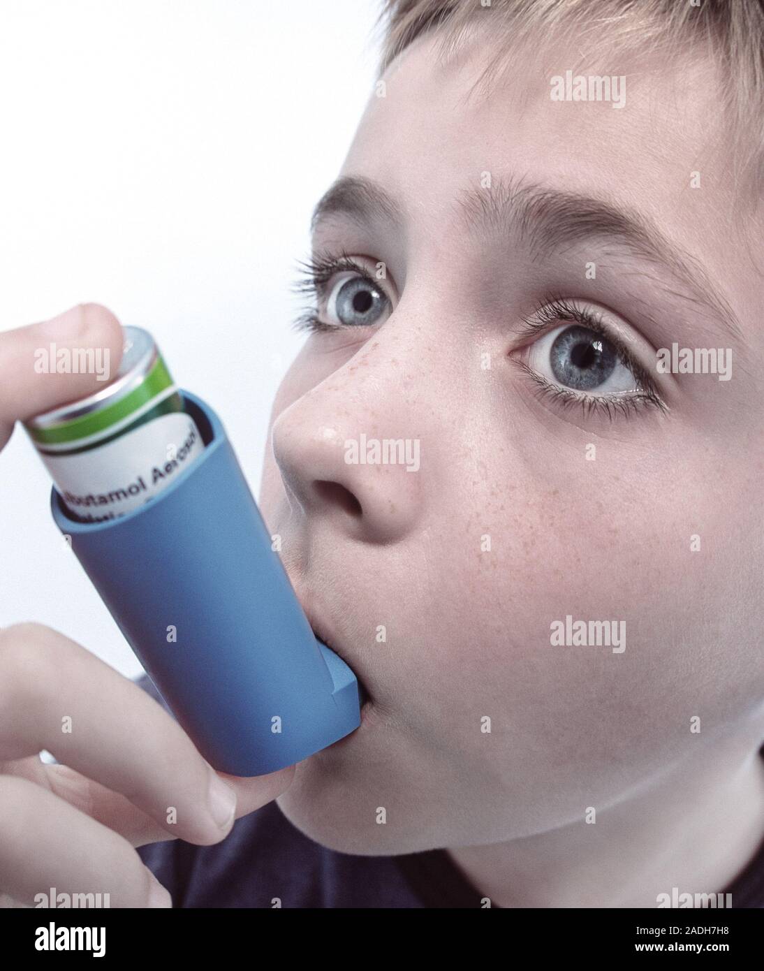Asthma attack. Boy using an inhaler to treat an asthma attack. Asthma