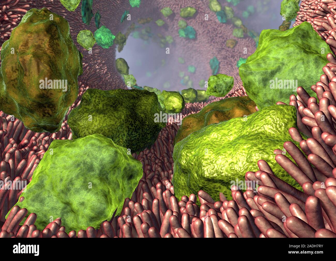 Asthma. Computer artwork of allergens (green) in the airways of the