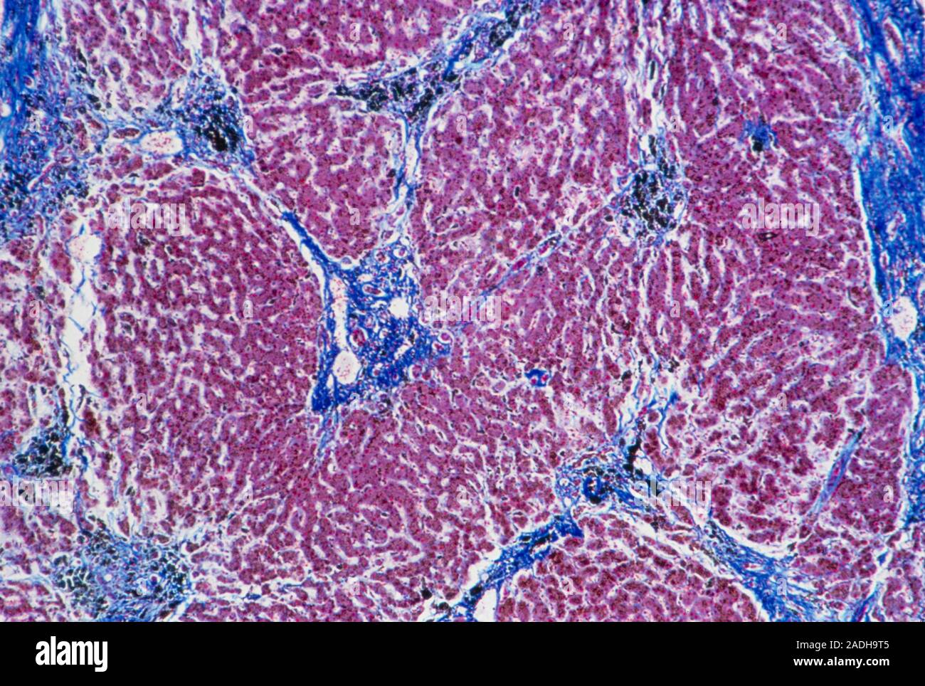Light micrograph of a section of the human liver showing a typical ...