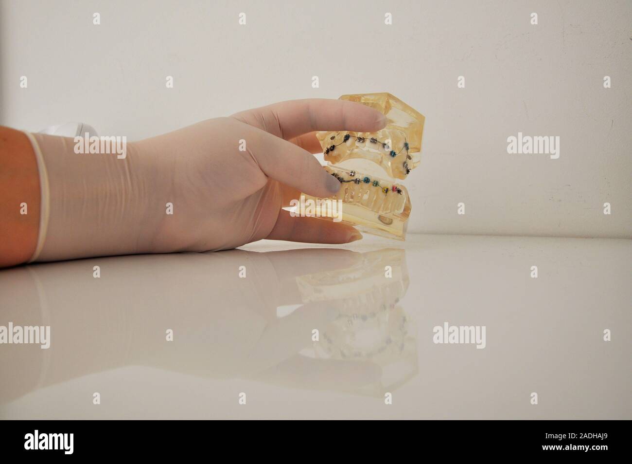 Woman hand holding dental false teeth model in dental Office ...