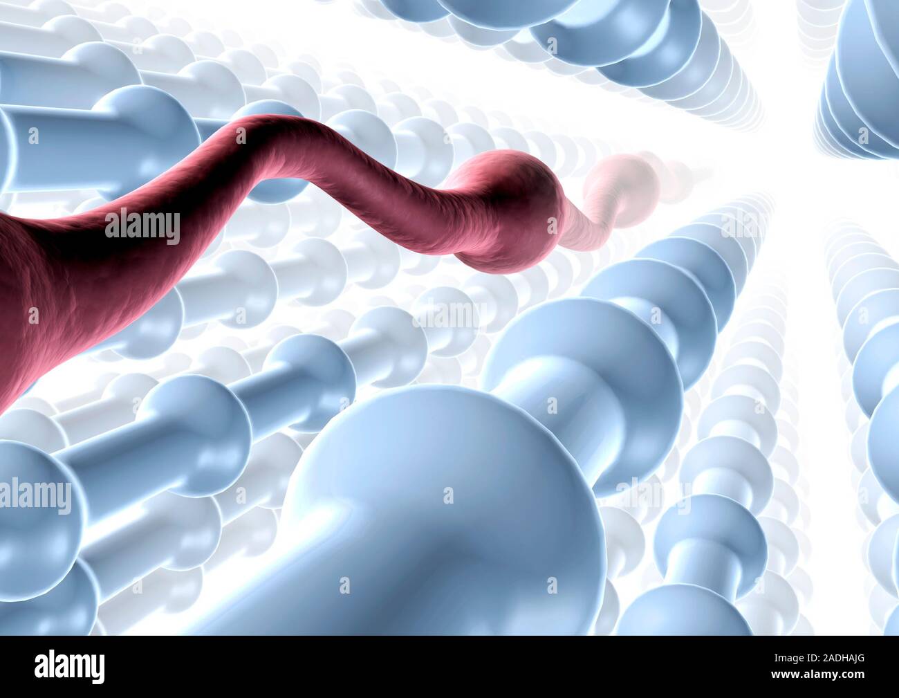 Constipation. Conceptual computer artwork of constipation, the ...