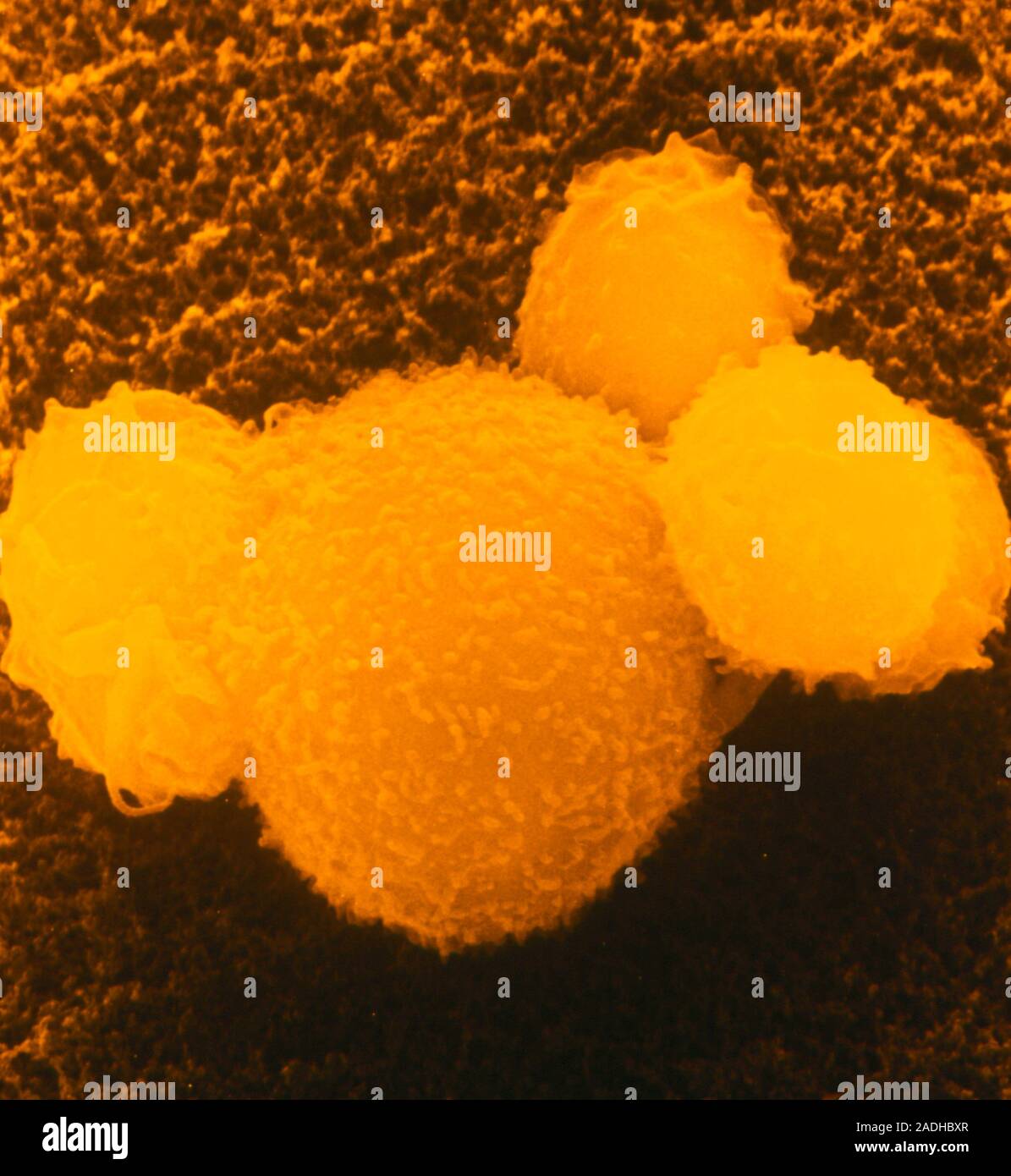 False-colour scanning electron micrograph (SEM) of 4 killer T ...