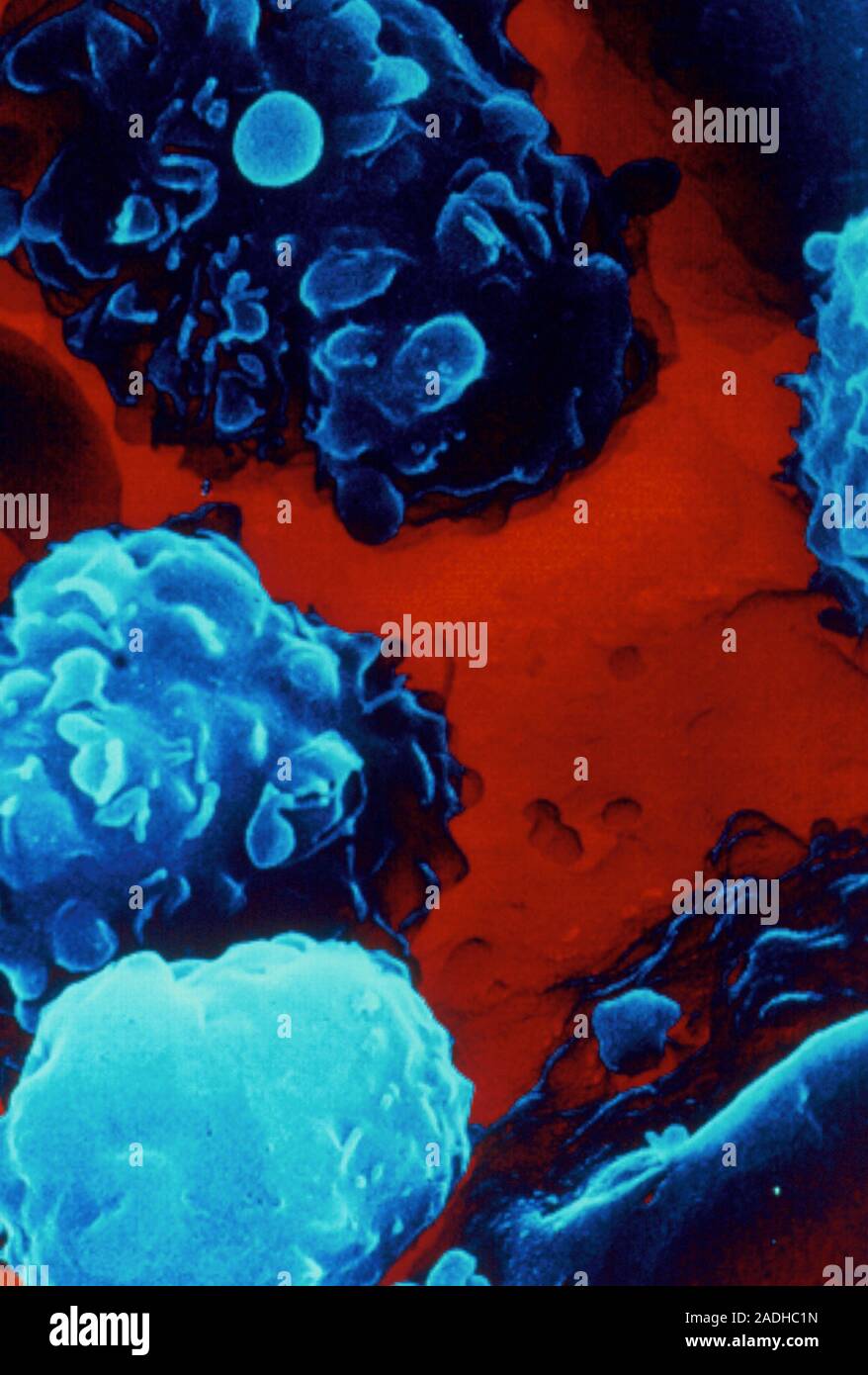 False-colour scanning electron micrograph (SEM) of a sample of blood ...
