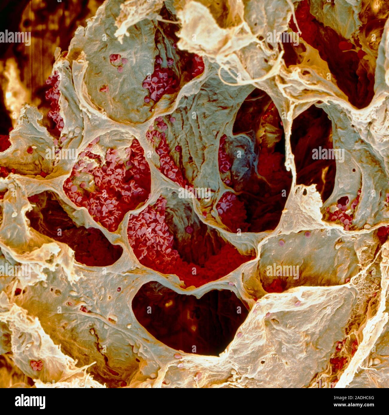 Почему кровь желтая. Кровь курильщика под микроскопом. Лёгкие курильщика под микроскопом.