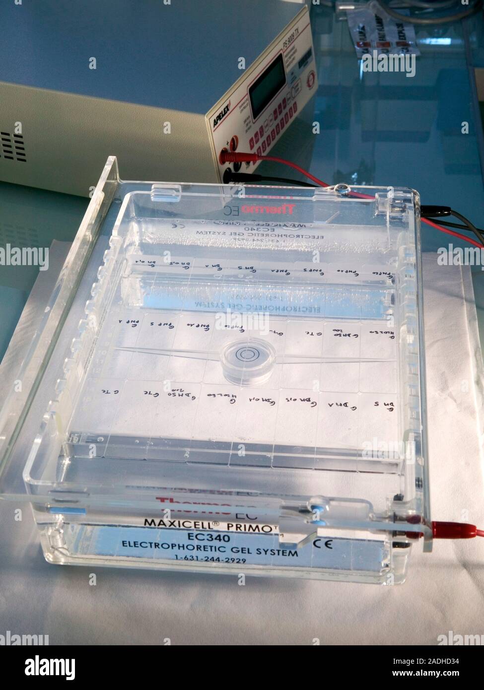 Cancer research. Tray of electrophoresis gel in use in a cancer