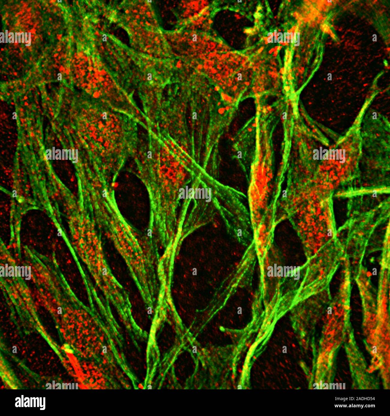 Brain protein in cancer research, fluorescence deconvolution micrograph