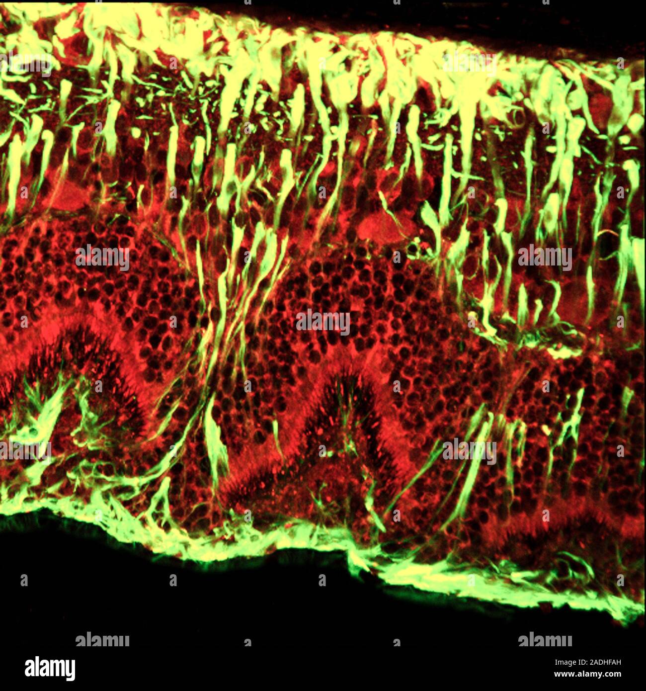 Detached retina. Confocal light micrograph of a section through a ...