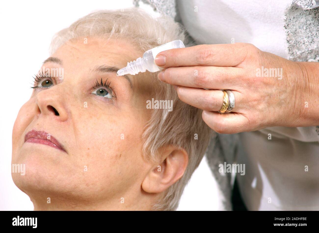 Eye drops. Patient using eye drops to treat an eye condition. Eye drops