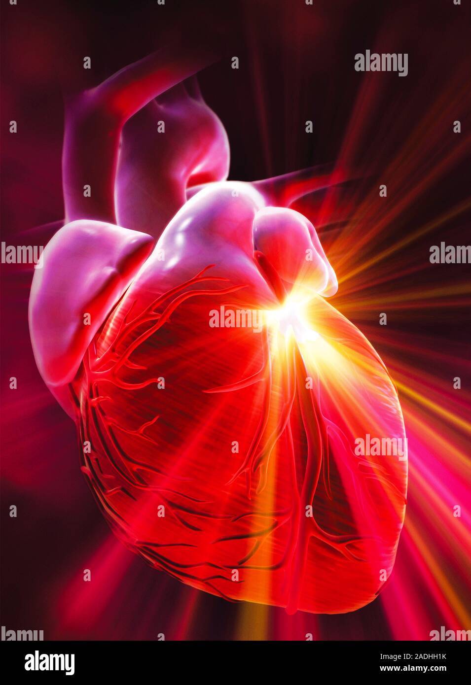 Heart attack. Conceptual computer artwork representing a heart attack ...