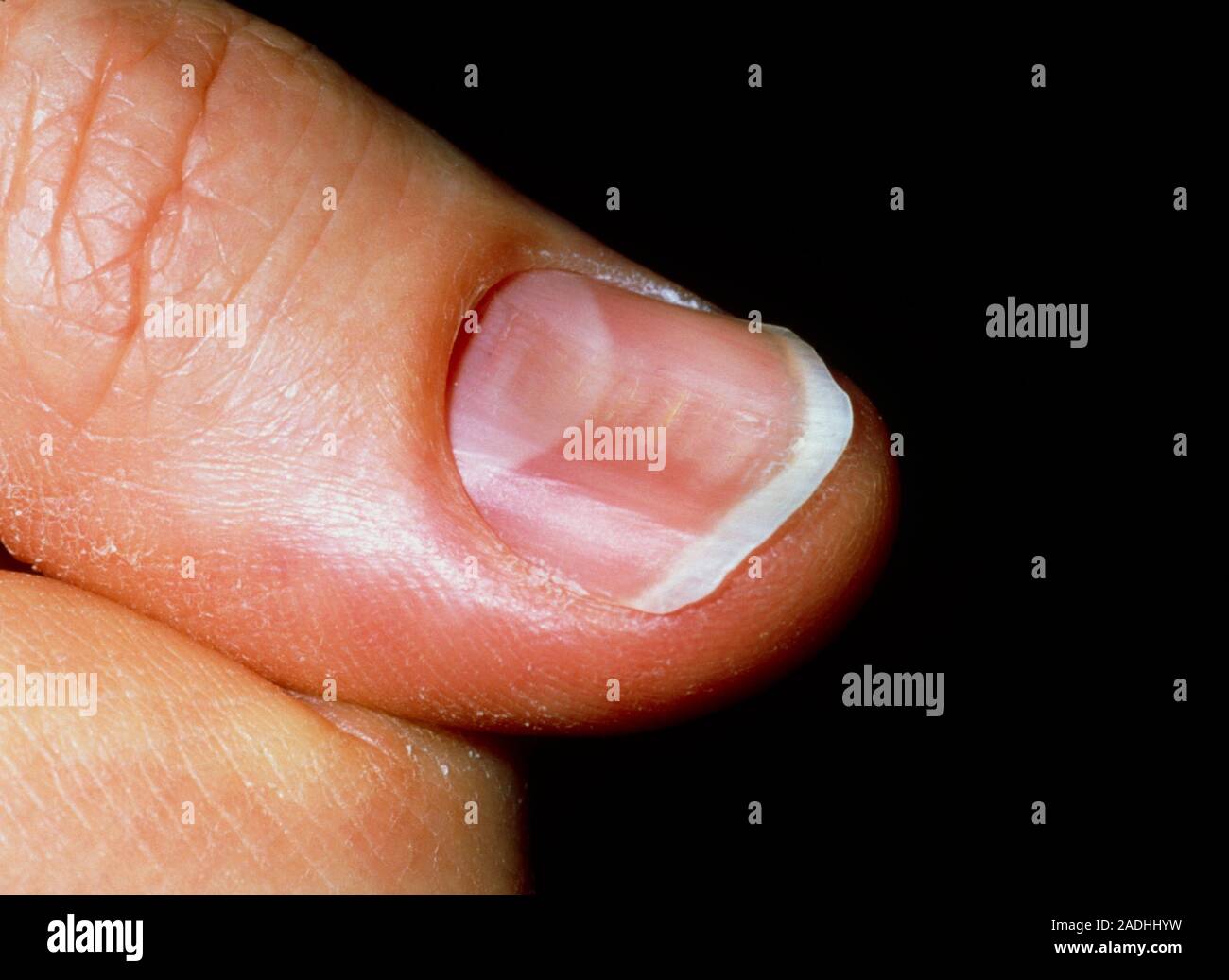 Concave nails discount