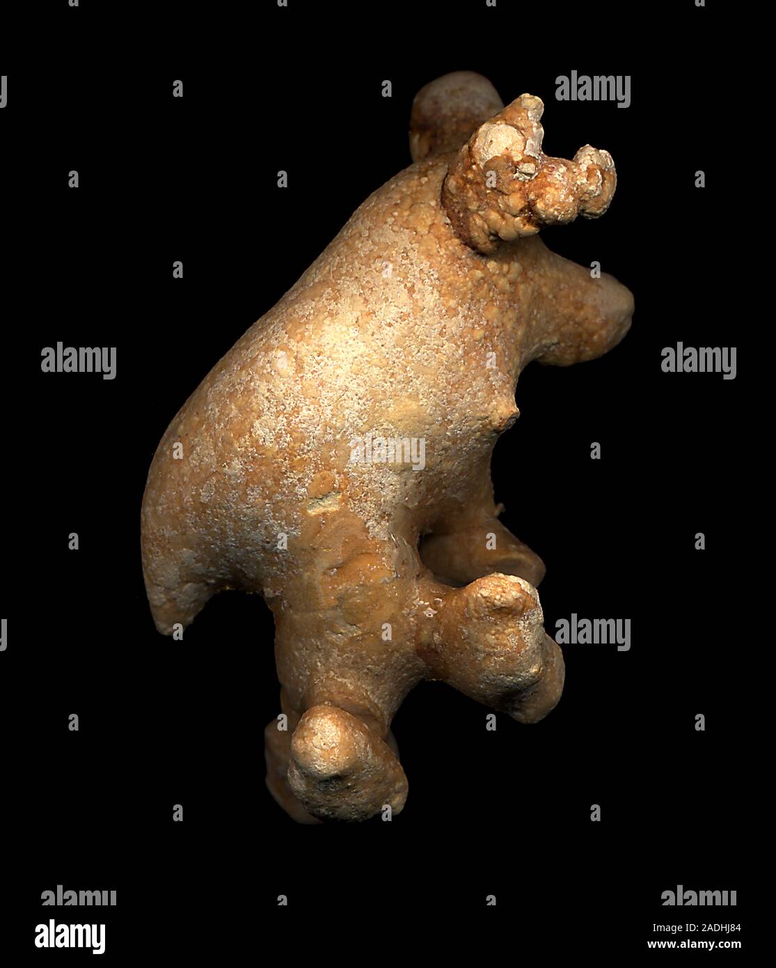 Kidney stones. Gross specimen of part of a 56- year-old patient's