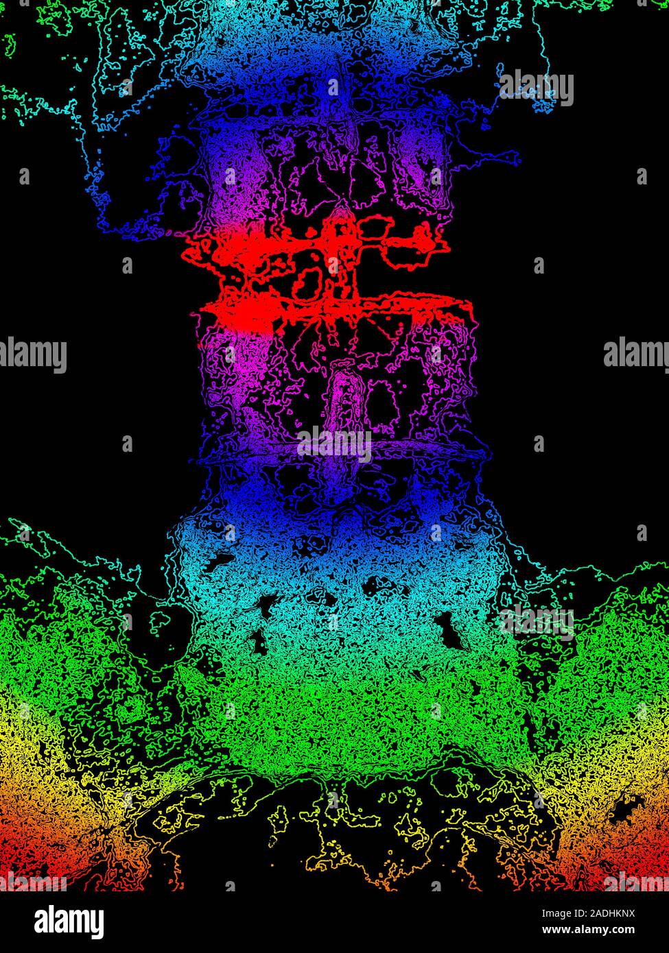 Osteoporosis of spine. Computer artwork of bones in the lower back of a