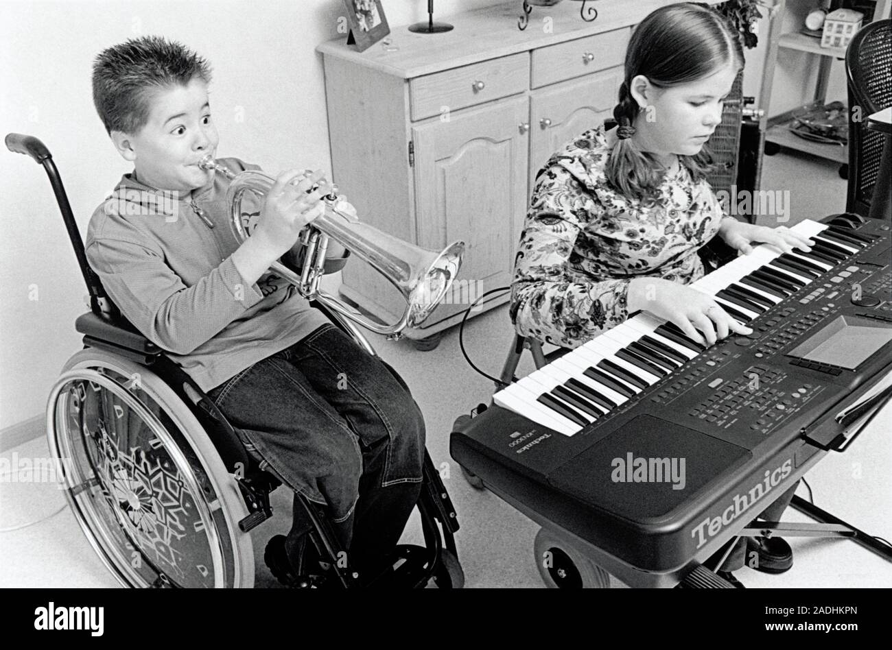 Brittle bone disease. Eighteen yearold girl and eleven yearold boy with osteogenesis