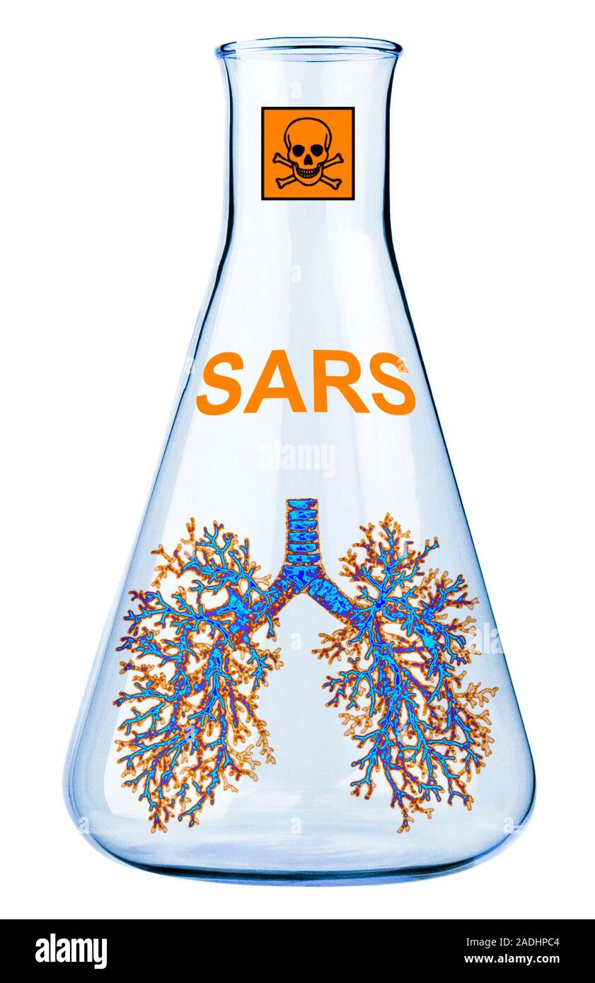 Sars Picture Example Severe acute respiratory syndrome (SARS). Conceptual image of the ...
