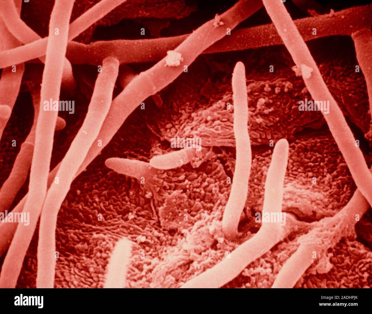 Falsecolour scanning electron micrograph (SEM) of the fungus that