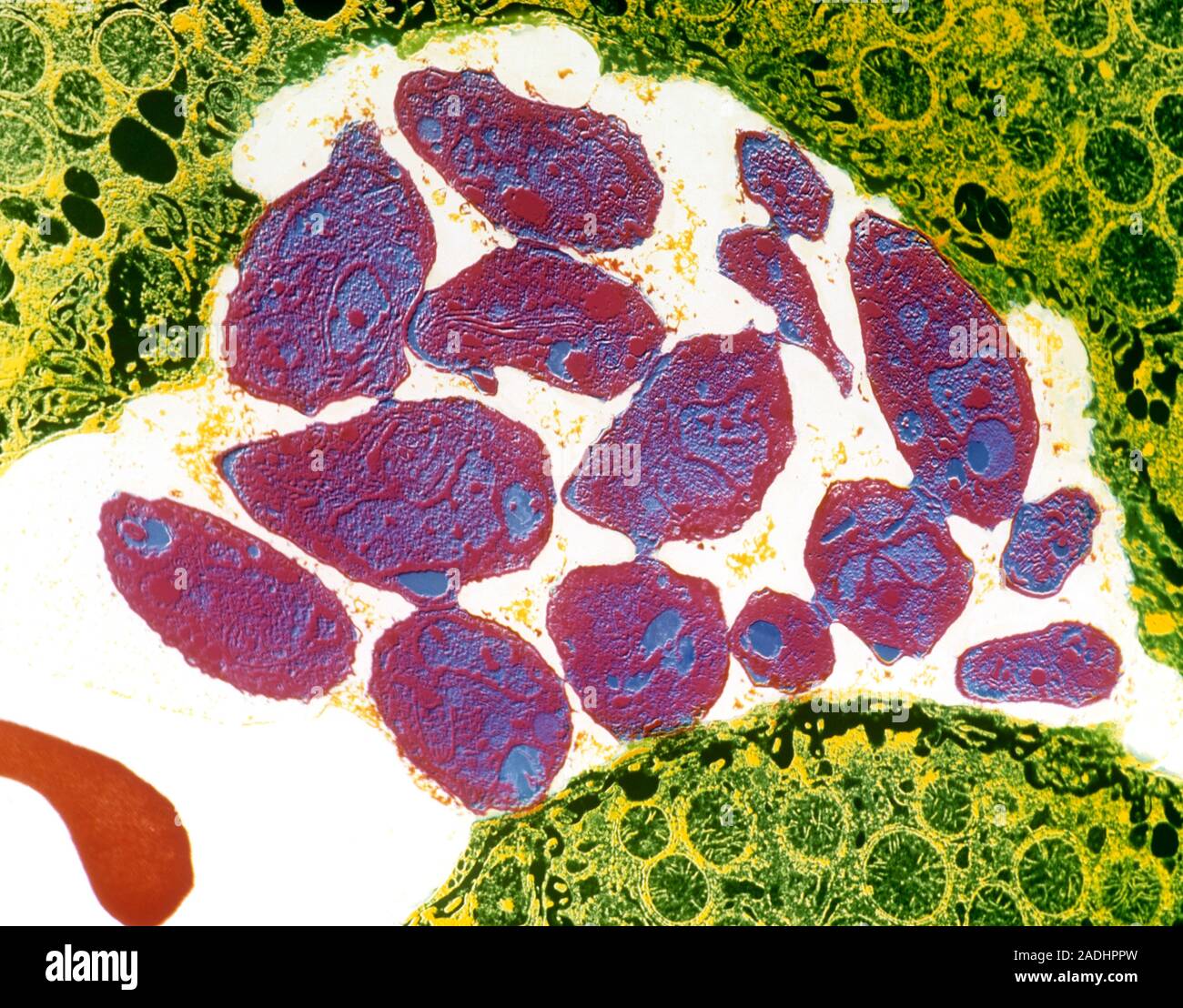 False colour transmission electron micrograph of the trophozoite, or ...