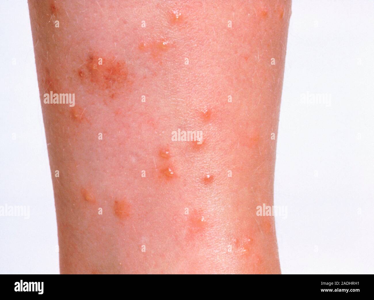 Cat Fleas: Identification, Life Cycle, and Treatment - Cats.com - Cat Flea Bites On Face
