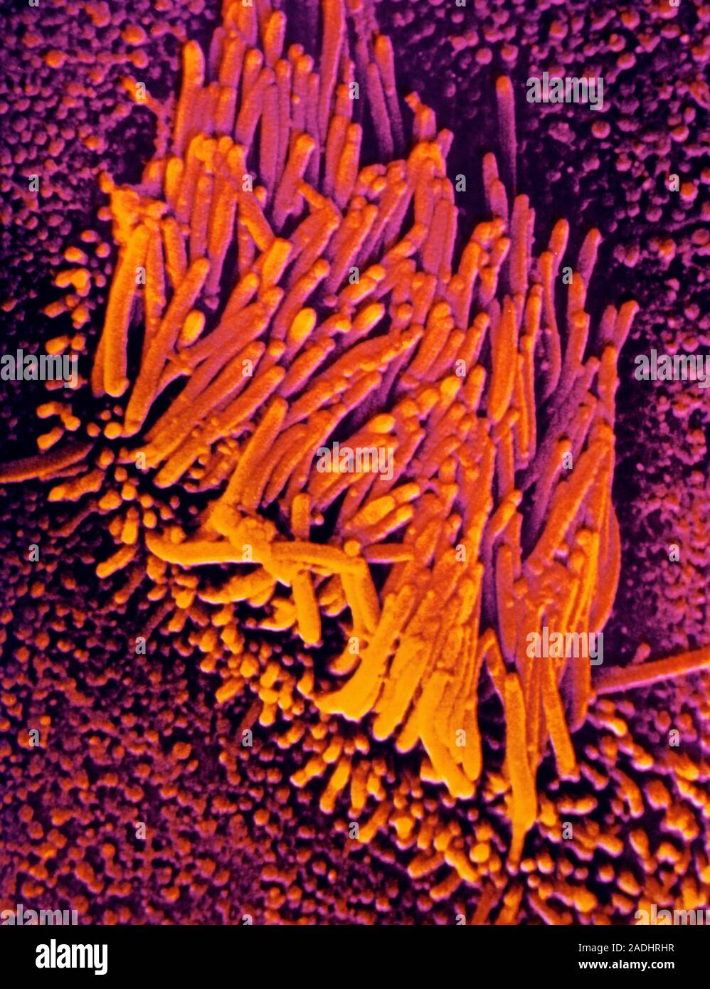 False-colour scanning electron micrograph (SEM) of human nasal mucosa ...
