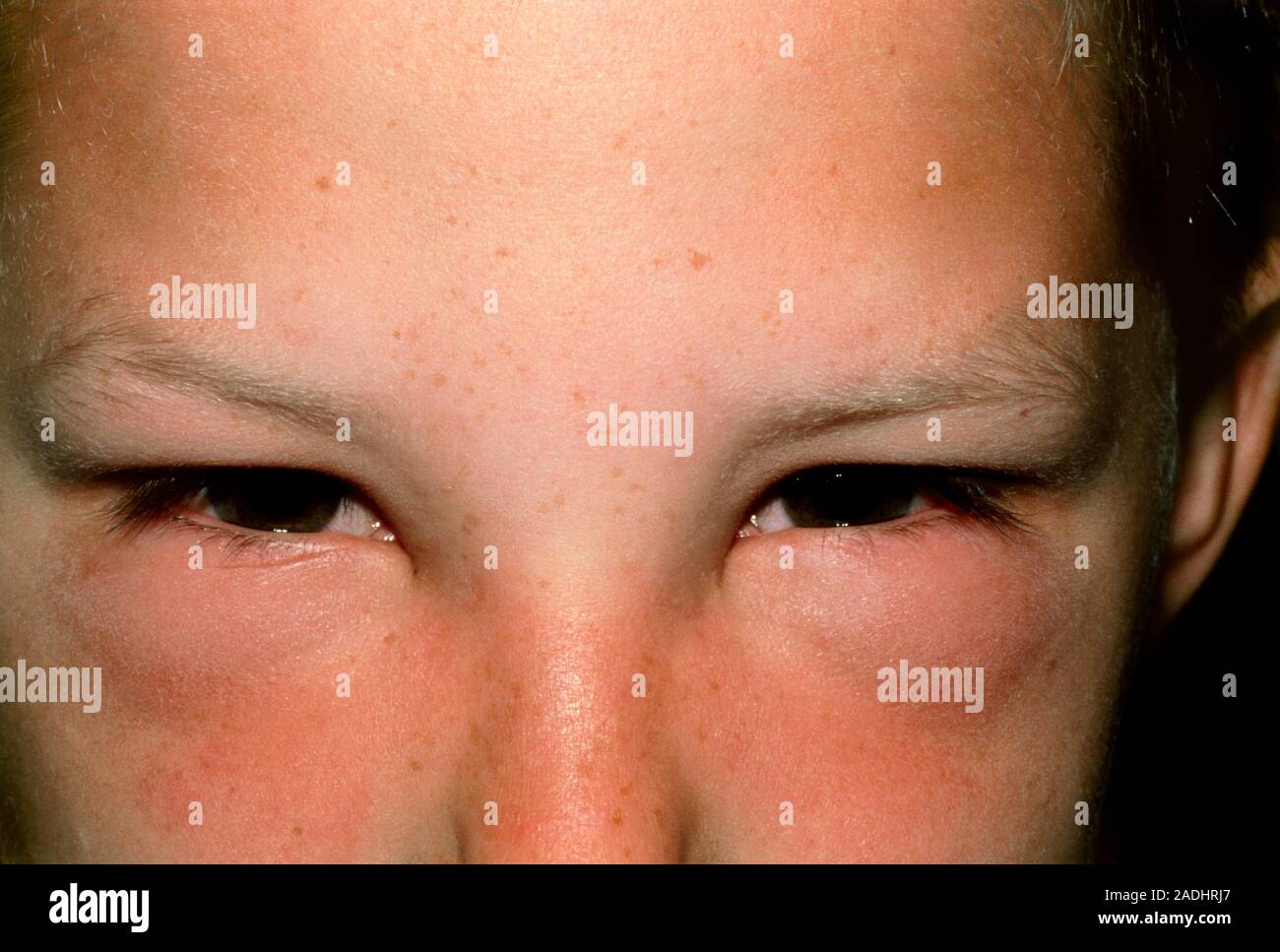 мас тени shale. Mac eye shadow haux. аллергический отек глаз. Mac haux на глазах. Tom ford emotionproof eye color.