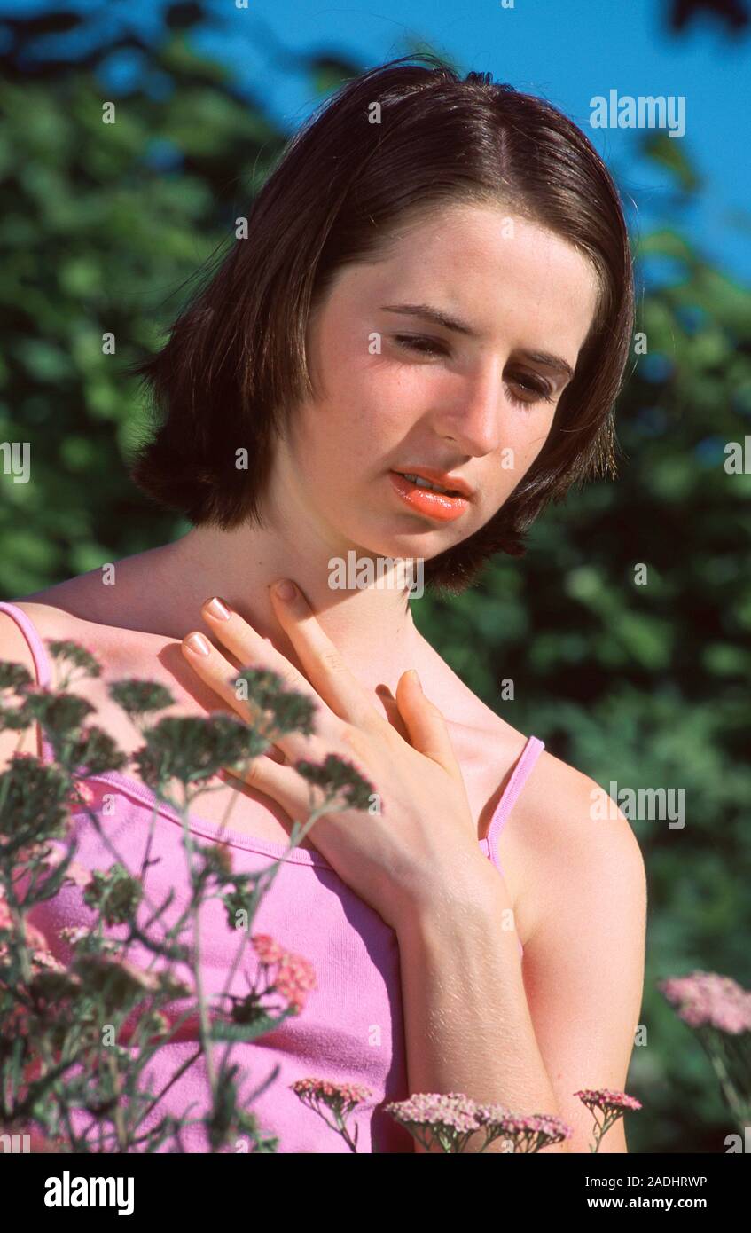 MODEL RELEASED. Hay fever. Teenage girl suffering with hay fever. Hay fever is an allergic
