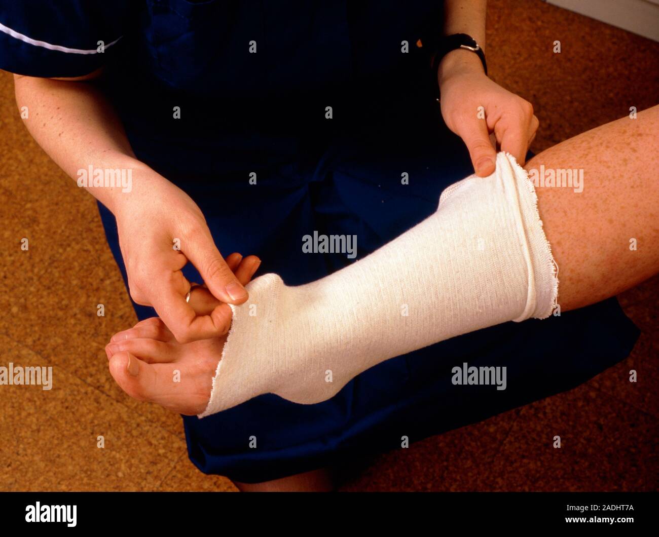 Nurse applying an elastic stocking bandage to a sprained ankle. A