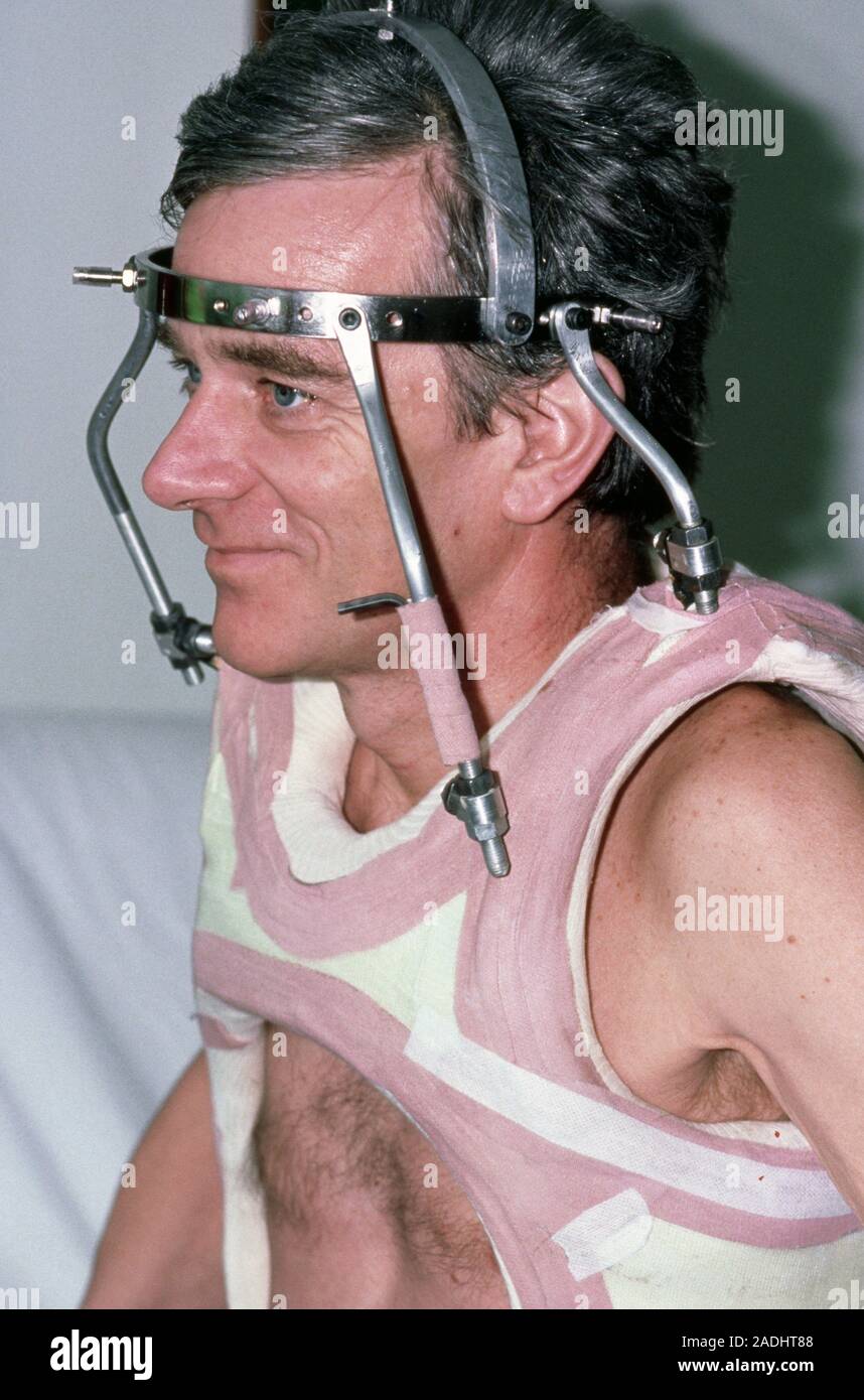 Model released. Man wearing a neck brace after fracturing four cervical