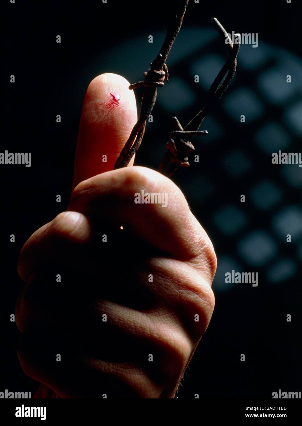 Barbed wire injury. Puncture wound on the finger caused by a prick from rusted barbed wire