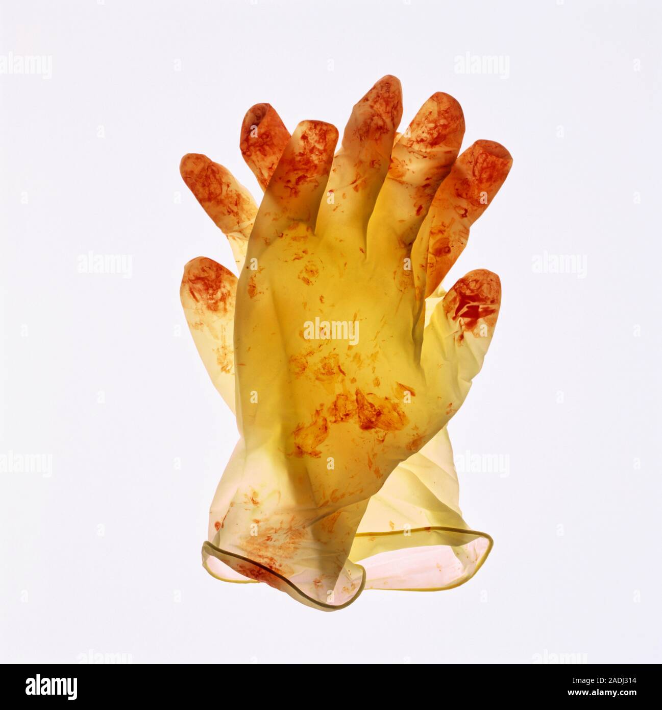 Bloodstained surgical gloves discarded after an operation Stock Photo