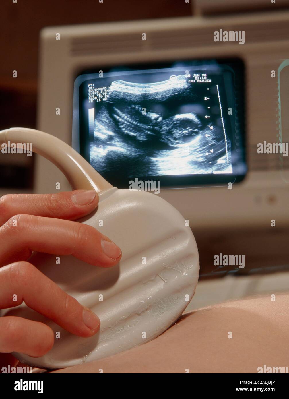 Ultrasound in pregnancy. Woman's abdomen in early pregnancy receives an