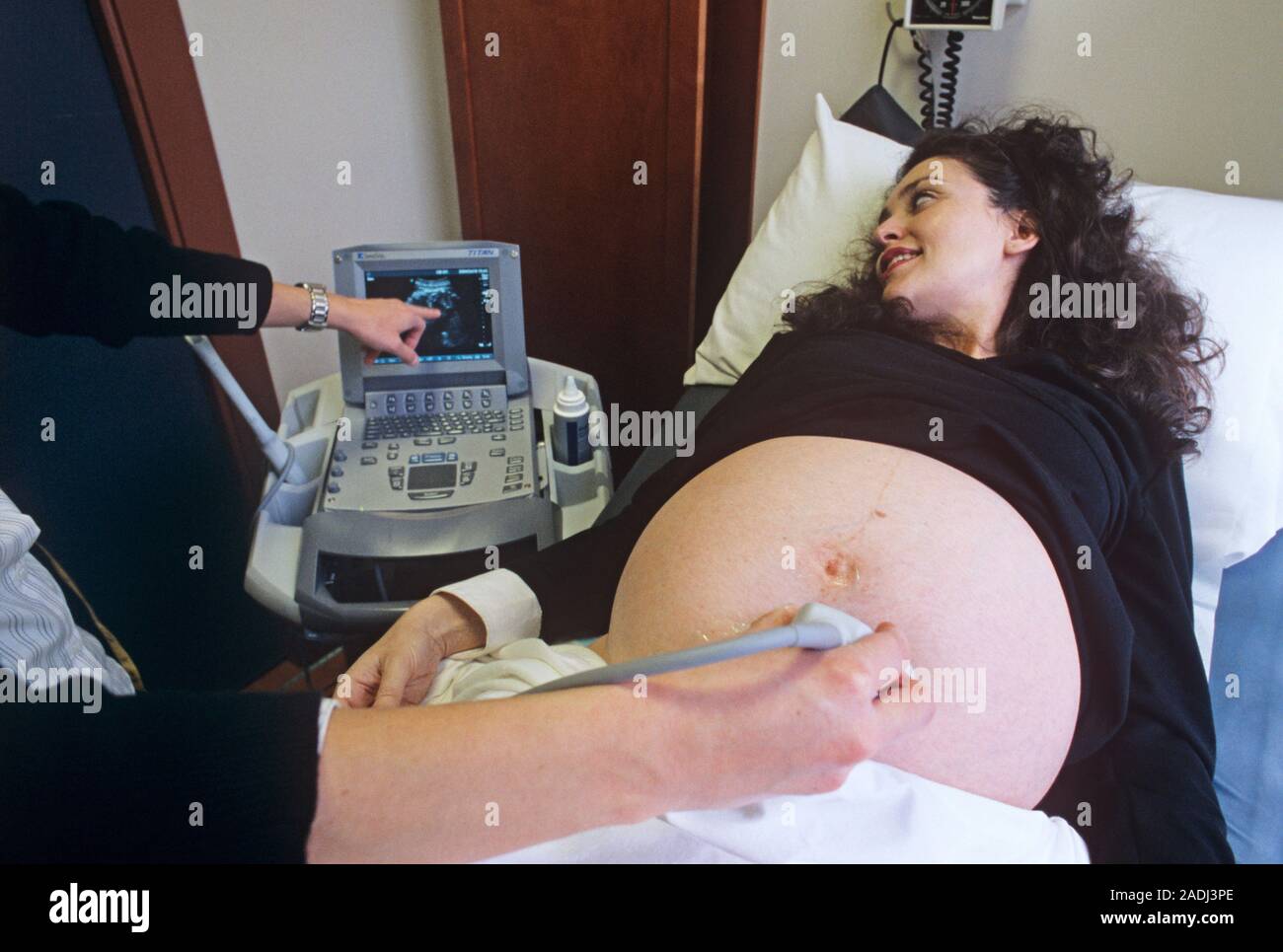 Pregnancy ultrasound scan. Doctor using an ultrasound transducer (in hand) to scan a pregnant
