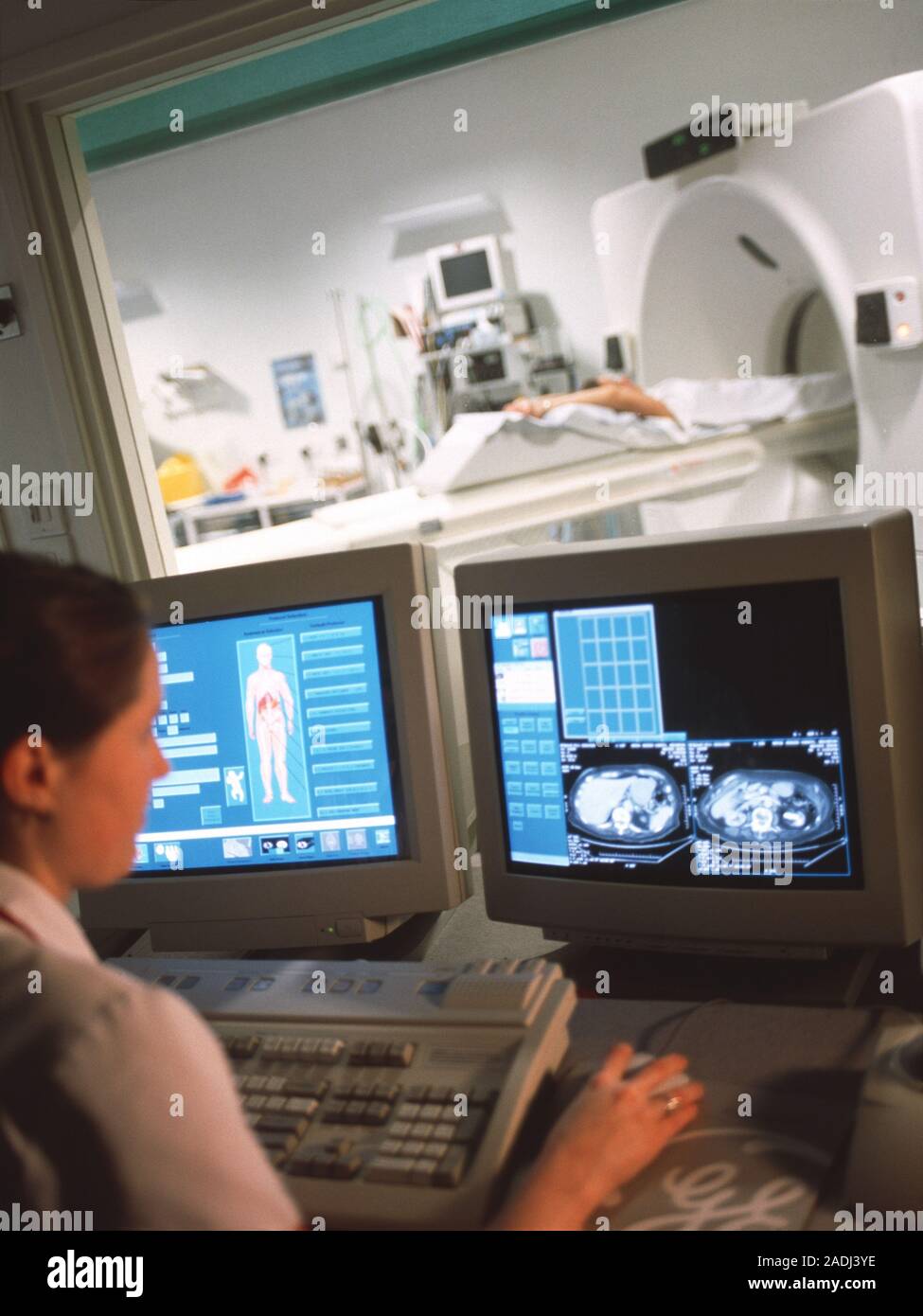 CT scanning. Radiologist examining CT (computed tomography) scans ...