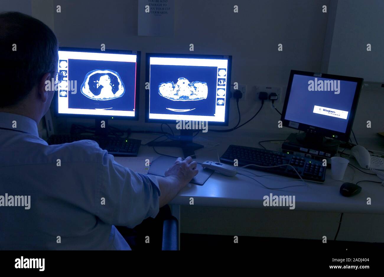 CT scans. Technician viewing computed tomography (CT) scans on computer ...