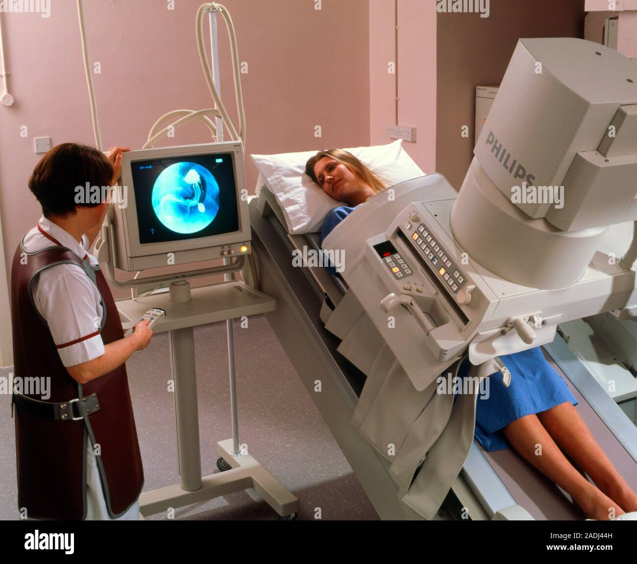 Процедура ирригоскопия кишечника. Рентген скопия кишечника. Обследования кишечника ирригоскопия. Рентген желудка Тренделенбурга. Рентгенография кишечника с барием.